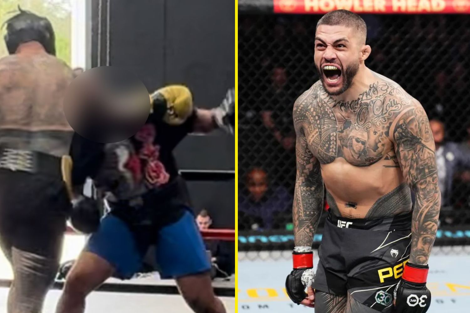 Ex-UFC star Tyson Pedro shares photo of horrific injury that caused boxing debut to be cancelled